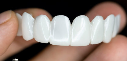 Dental Prosthetics