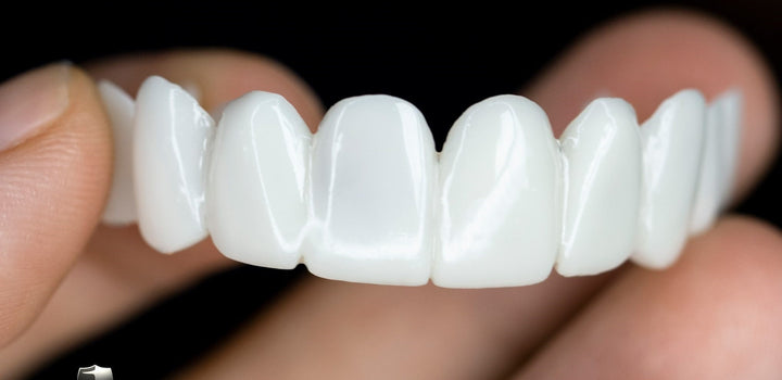 Kalsten | Smile Lens – Adjustable White Denture for Direct Smile Correction