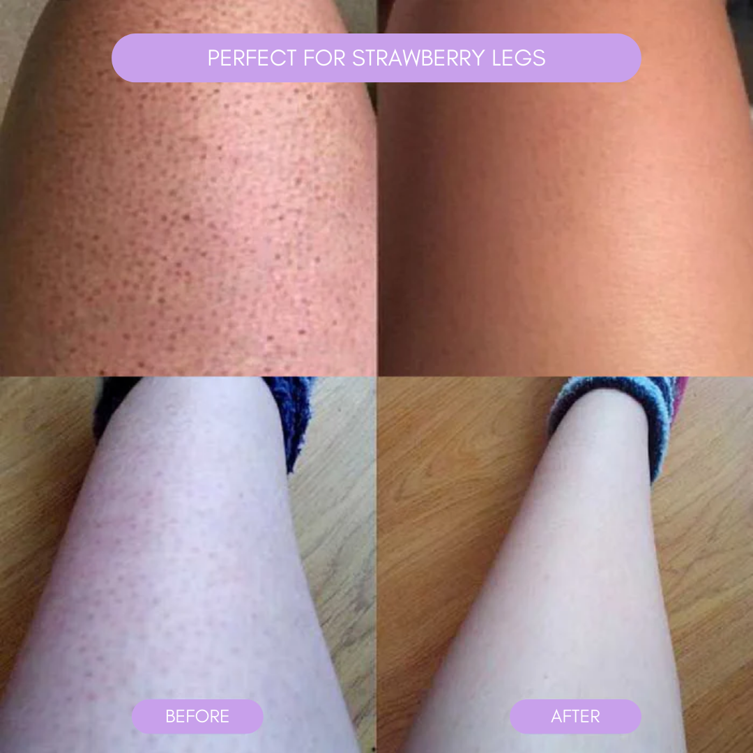 Hair Removal Device for Smooth Skin Kalsten
