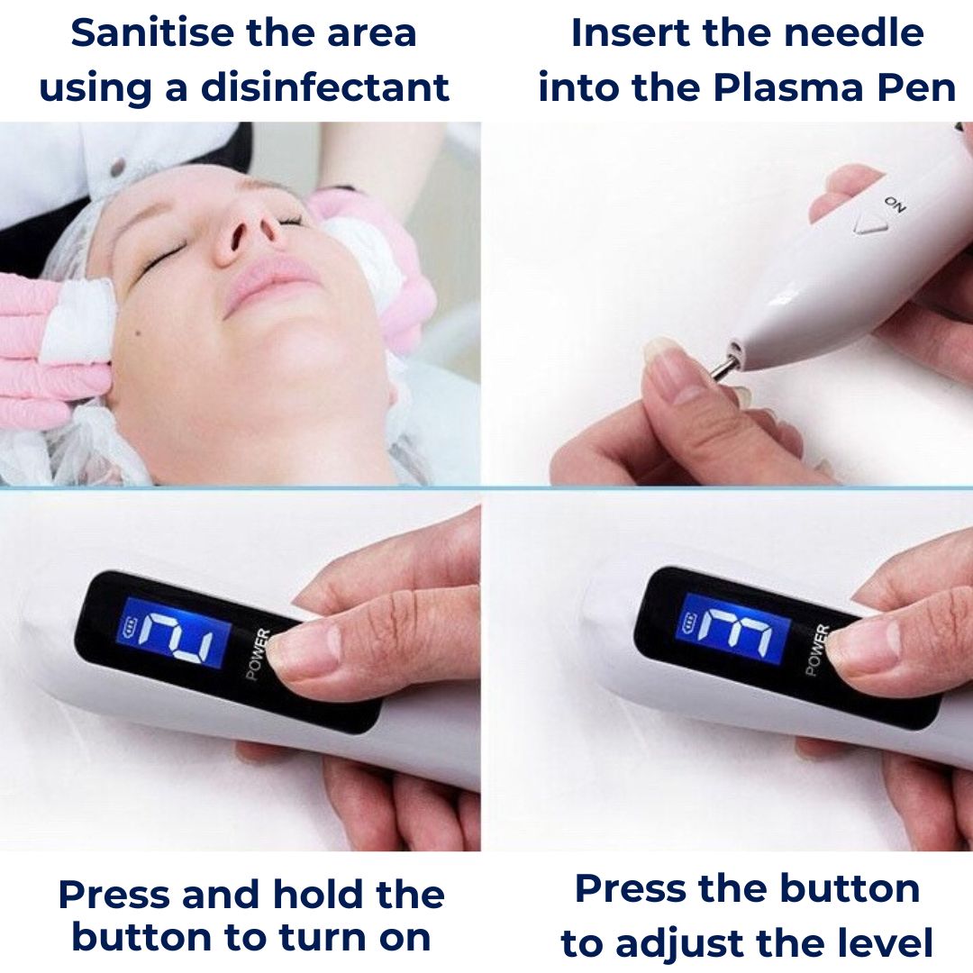 ClearSkinPro Laser Plasma Pen - Non-Invasive | for Freckle, Skin Tag, Spot, Mole and Tattoo Removal at Home Kalsten