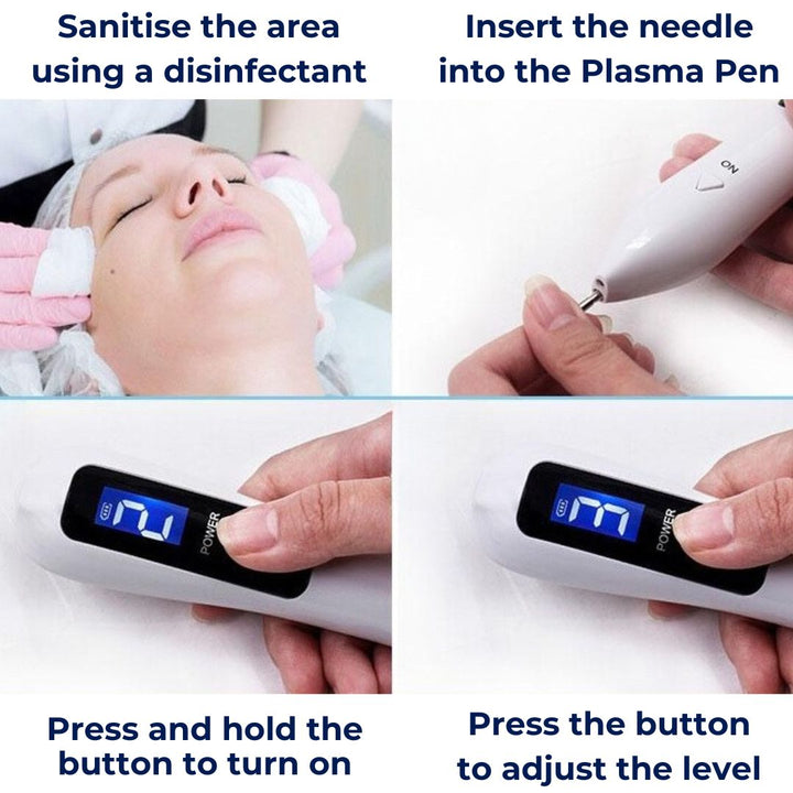 ClearSkinPro Laser Plasma Pen - Non-Invasive | for Freckle, Skin Tag, Spot, Mole and Tattoo Removal at Home Kalsten