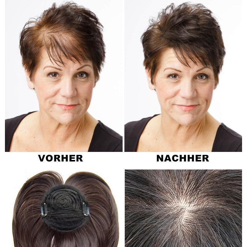 Kalsten | Special Head Hair Piece