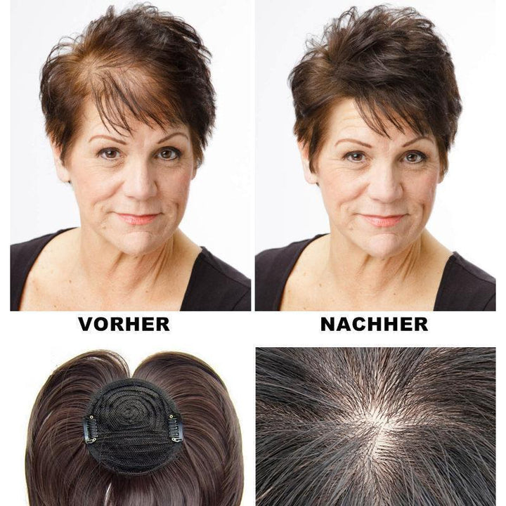 Kalsten | Special Head Hair Piece