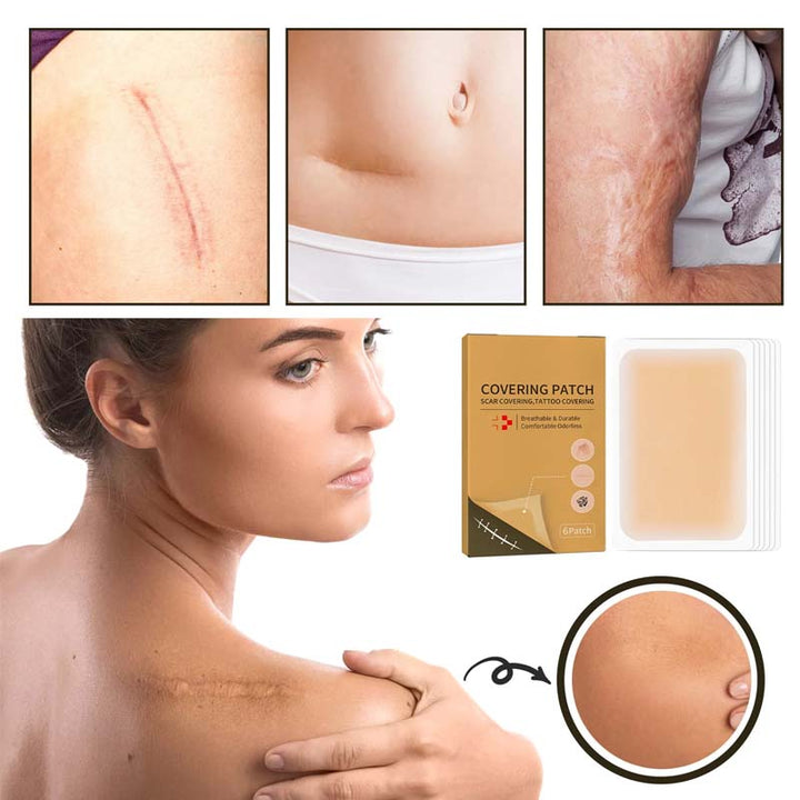 Kalsten | Skin Invisible Concealer Patch