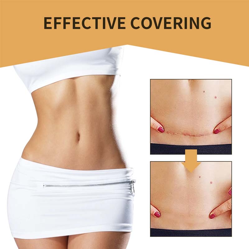 Kalsten | Skin Invisible Concealer Patch