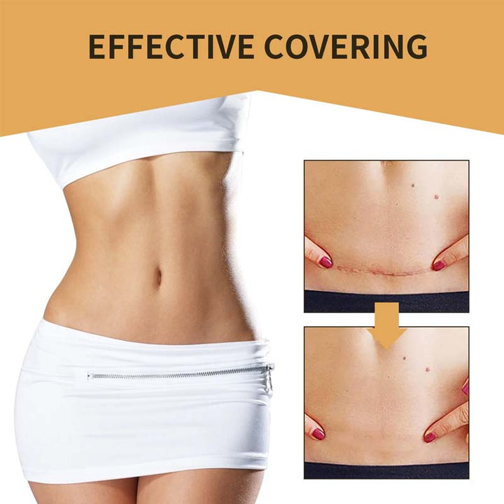 Kalsten | Skin Invisible Concealer Patch
