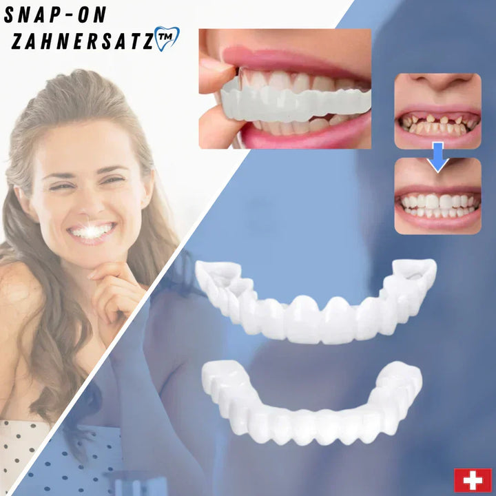 Kalsten | SnapFit Dental Restoration | Always a Flawless Smile