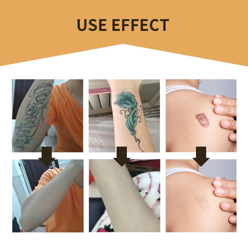 Kalsten | Skin Invisible Concealer Patch