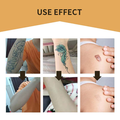 BowLift | Skin Invisible Concealer Patch