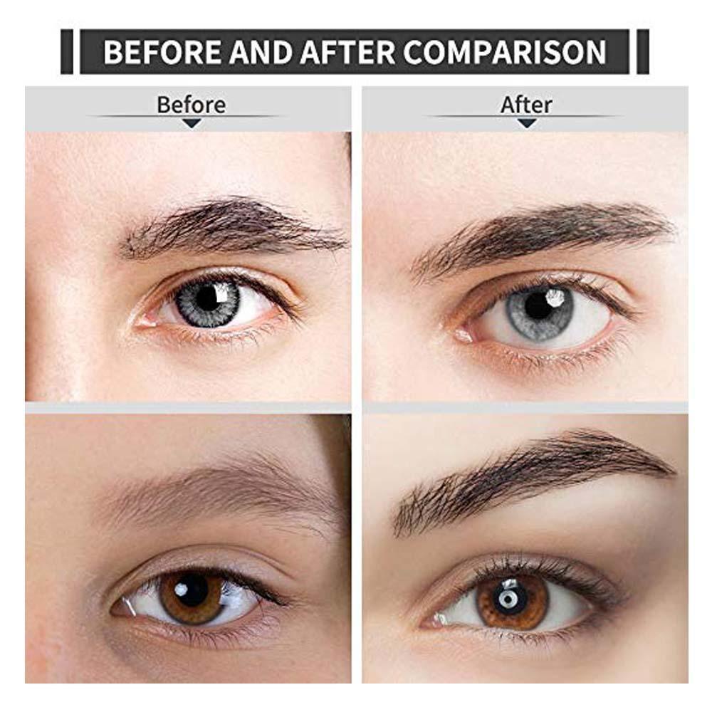 Skanto Skanto | Painless Eyebrow Epilator