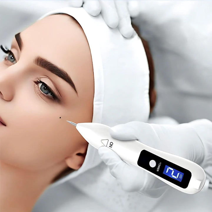 ClearSkinPro Laser Plasma Pen - Non-Invasive | for Freckle, Skin Tag, Spot, Mole and Tattoo Removal at Home Kalsten