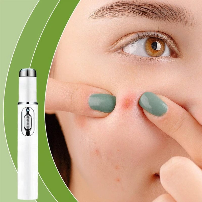 Kalsten | ClearDerm - Quick, painless pimple removal for smooth, clear skin