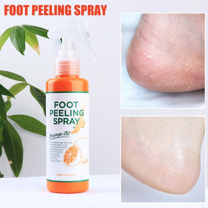 Kalsten | Foot Peeling Spray