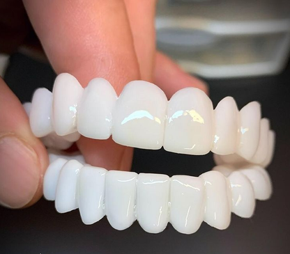 Skanto | 100% Adjustable Whitening Fake Invisible Gap-Free Braces