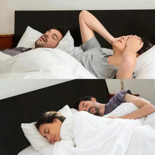Skanto | Mikro CPAP Sleep Apnea Machine for Travel and Anti-Snoring – CPAP Alternative