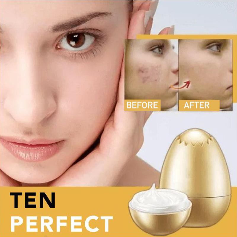 Kalsten | Hefe Gold Egg Mask
