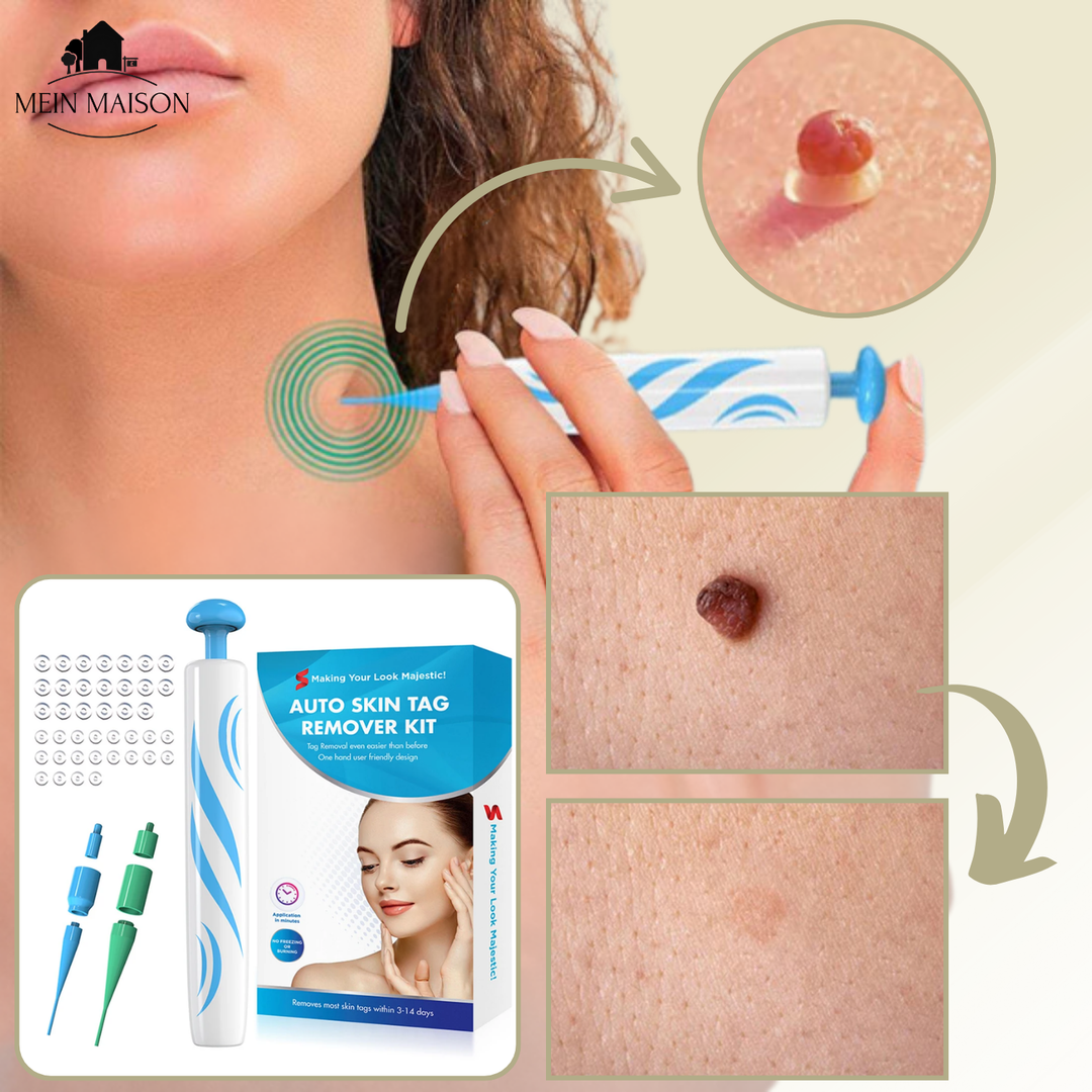 Kalsten | DermaLinx Wart Remover | Pain-Free Removal of Warts & Moles | For Home | Without Surgery