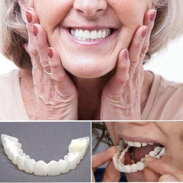 Instant Smile Veneers (Upper & Lower Set)