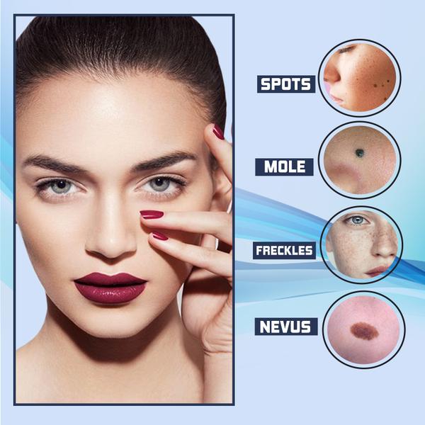 Kalsten | SpotErase™ Perfect Spot Solution in Just Few Weeks