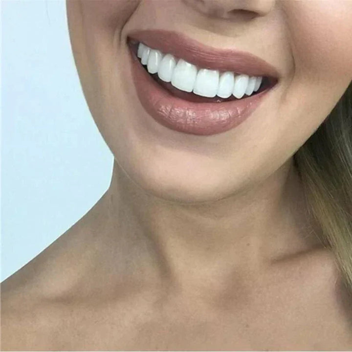 Kalsten | SnapFit Dental Restoration | Always a Flawless Smile