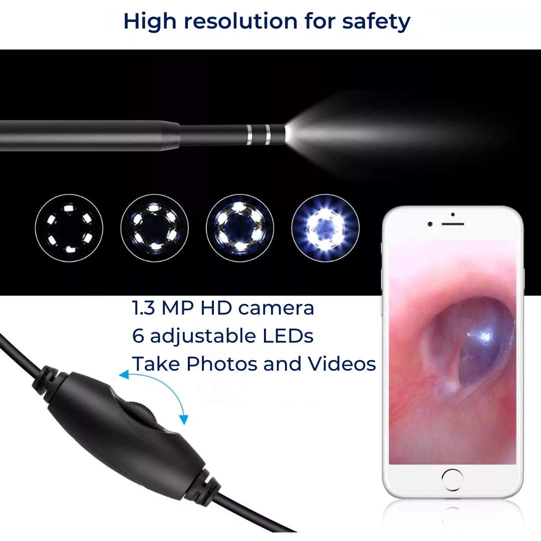 EarVision Professional Ear Endoscope – HD Inspection – Live Monitoring – Capture Images & Video – Removes Wax & Foreign Objects Kalsten