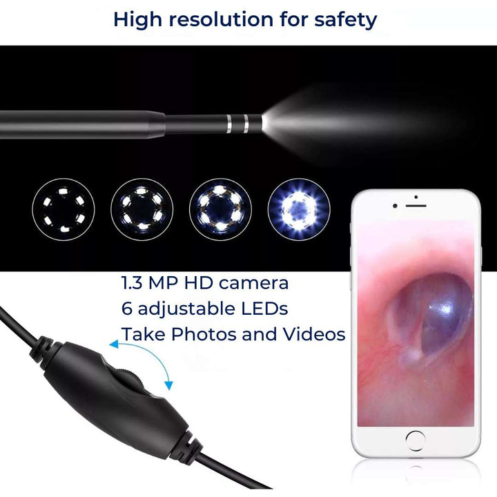 EarVision Professional Ear Endoscope – HD Inspection – Live Monitoring – Capture Images & Video – Removes Wax & Foreign Objects Kalsten