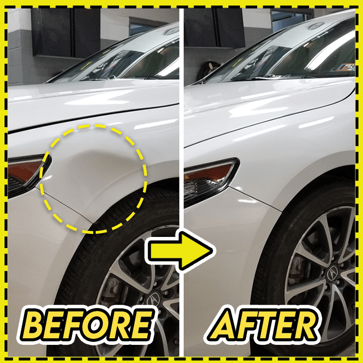 Mini Car Dent Repair Puller | Kalsten