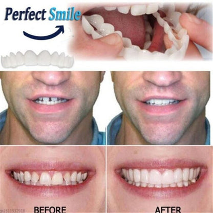 Adjustable, clip-on denture