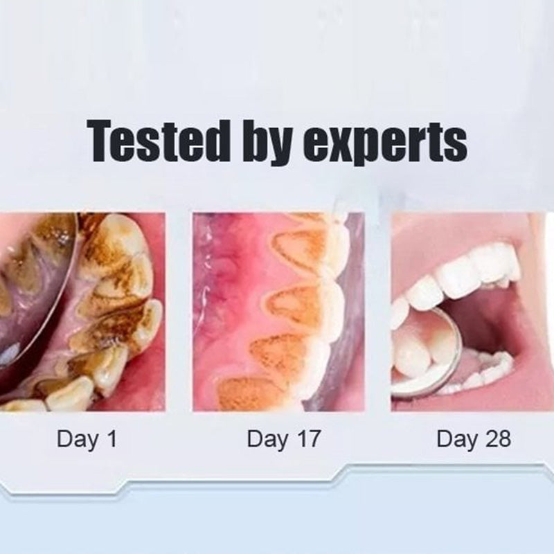 Kalsten | Super Probiotic-6 Toothpaste