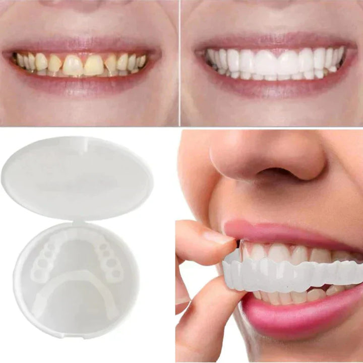 Kalsten | SnapFit Dental Restoration | Always a Flawless Smile