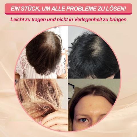 Kalsten | Special Head Hair Piece