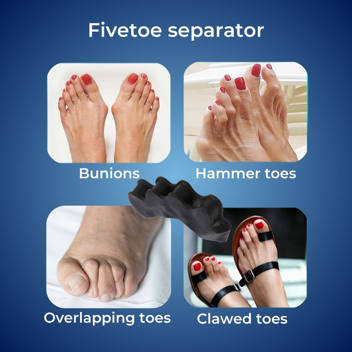 FlexAlign Toe Spacer | Toe Realignment and Pain Relief – Ideal for Bunions - Overlapping Toes - and Foot Comfort Kalsten