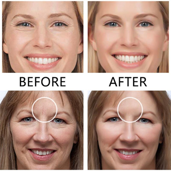 Kalsten | Face Nutrition Wrinkle Removal Lift Stickers
