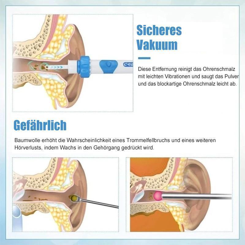 Earwax Remover Vacuum – Safe & Efficient