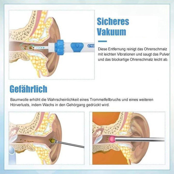 Earwax Remover Vacuum – Safe & Efficient