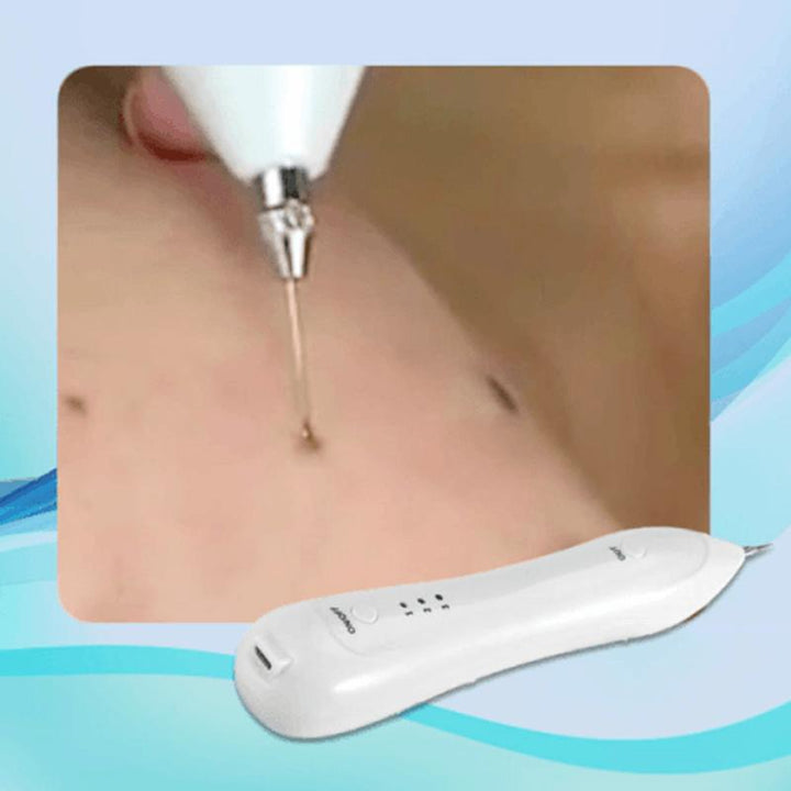 Kalsten | Facial Hair Removal Pen