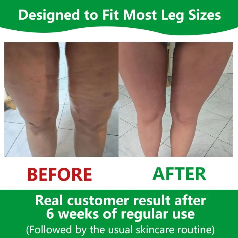 Kalsten | Sakerplus Cellulite Massage Roller