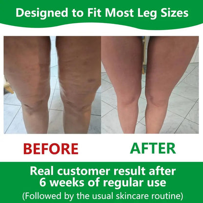 BowLift | Sakerplus Cellulite Massage Roller