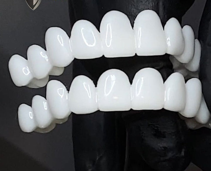 Kalsten | Smile Lens – Adjustable White Denture for Direct Smile Correction