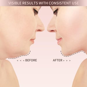 Kalsten | VitaLift – Naturally beautiful at any age