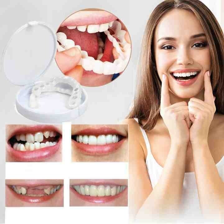 Kalsten | Adjustable Snap-On Dentures