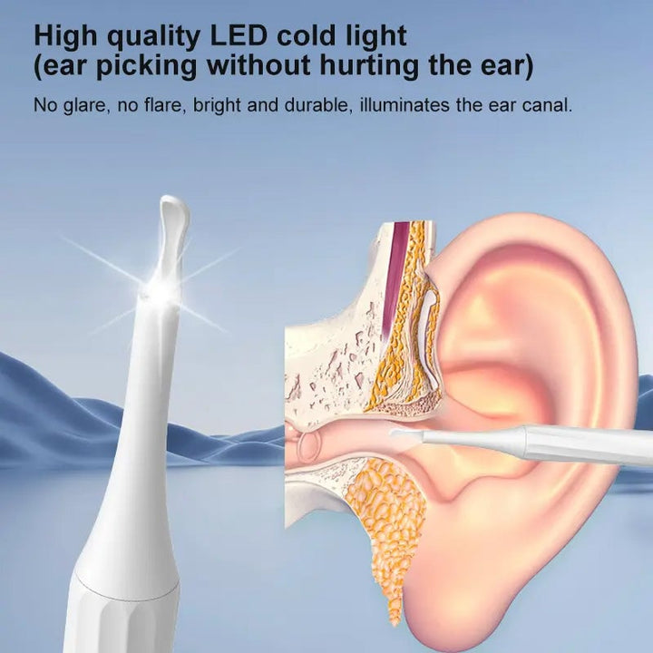 Kalsten | HD Camera Ear Wax Removal Kit