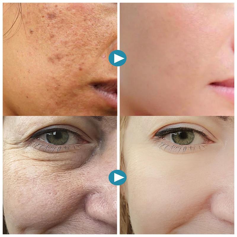 SilkPores Smooth and Radiant Skin | Kalsten