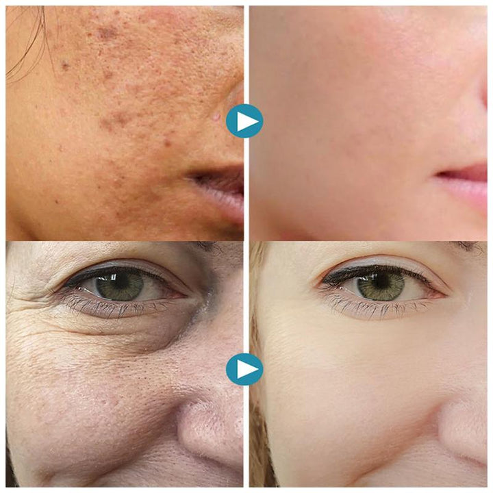SilkPores Smooth and Radiant Skin | Kalsten