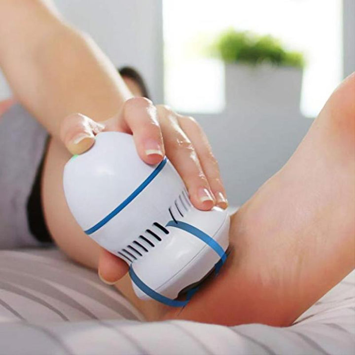 Automatic Callus Remover | Kalsten