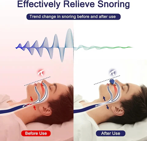 Kalsten | Micro CPAP Sleep Apnea Machine for Travel & Anti Snoring