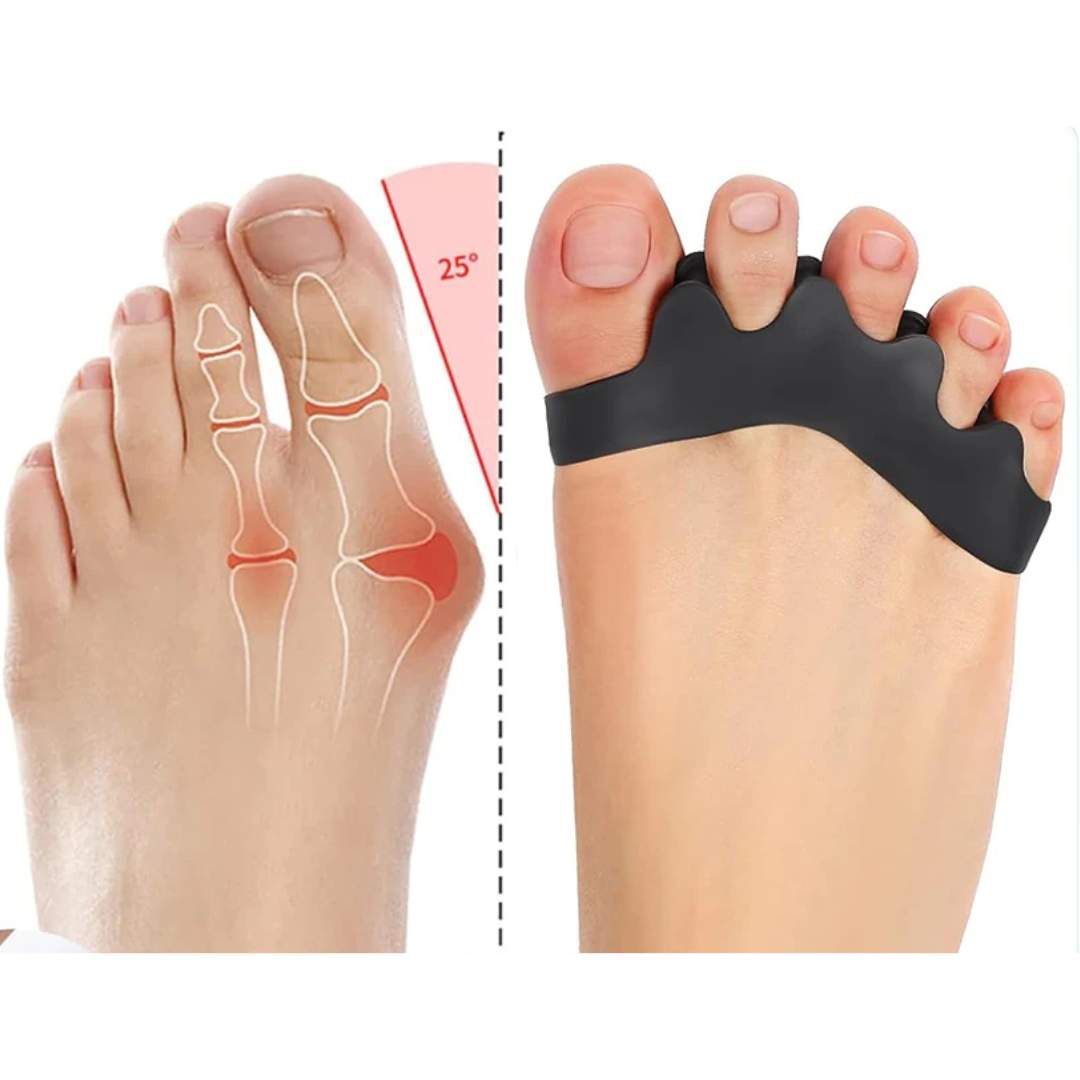 FlexAlign Toe Spacer | Toe Realignment and Pain Relief – Ideal for Bunions - Overlapping Toes - and Foot Comfort Kalsten