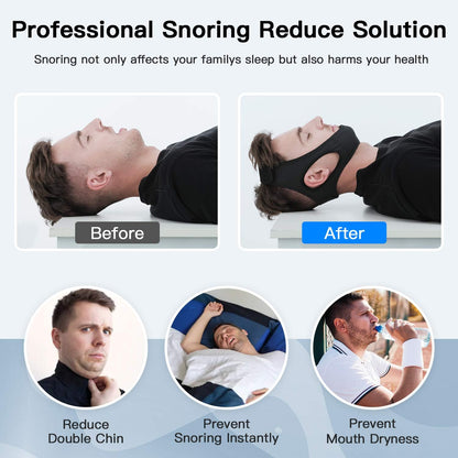Brehn | Anti-Snore Chin Strap for Sleep Apnea