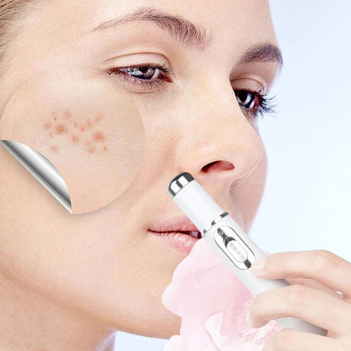 Kalsten | ClearDerm - Quick, painless pimple removal for smooth, clear skin