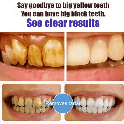 BowLift | Super Probiotic-6 Toothpaste